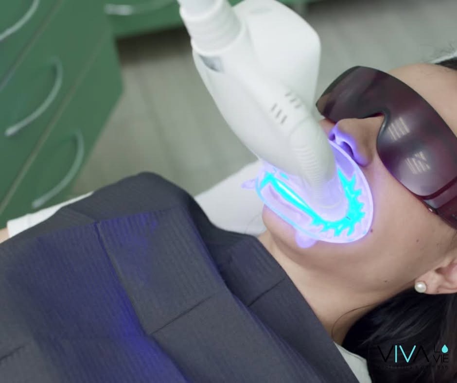 Professional teeth whitening treatment